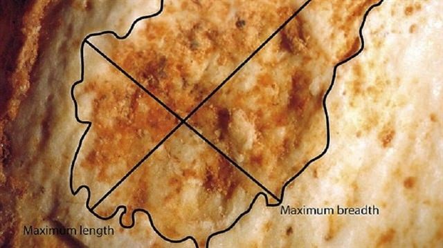 ISIRILARAK ÖLDÜĞÜ ORTAYA ÇIKTI