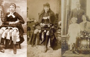 Myrtle Corbin: Dört Ayaklı Kadın