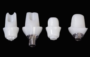 İmplant Diş Fiyatları Uygun mu?