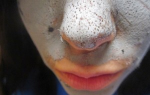 Siyah Noktalar Neden Oluyor?