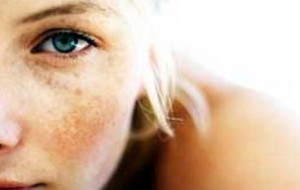 Sedef Hastalığının Doğal Tedavisi