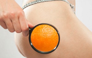 Selülitin Safhaları Ve Çözümü