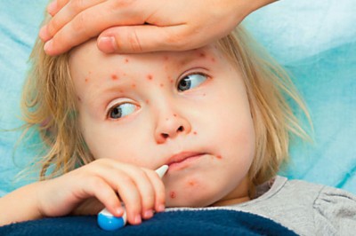 Kızamıkçık Hastalığı Nedir?