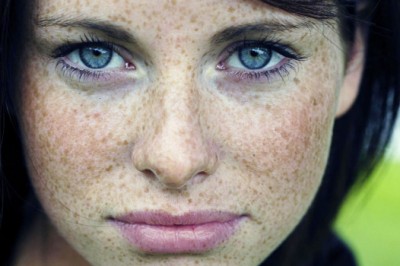 Güneş Lekelerine Son Veren Maske Tarifi