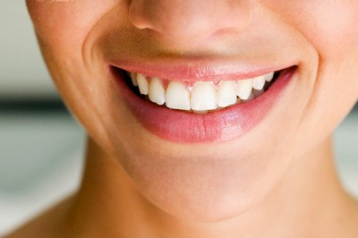Sağlıklı Dişler İçin Diş Taşı Temizliği